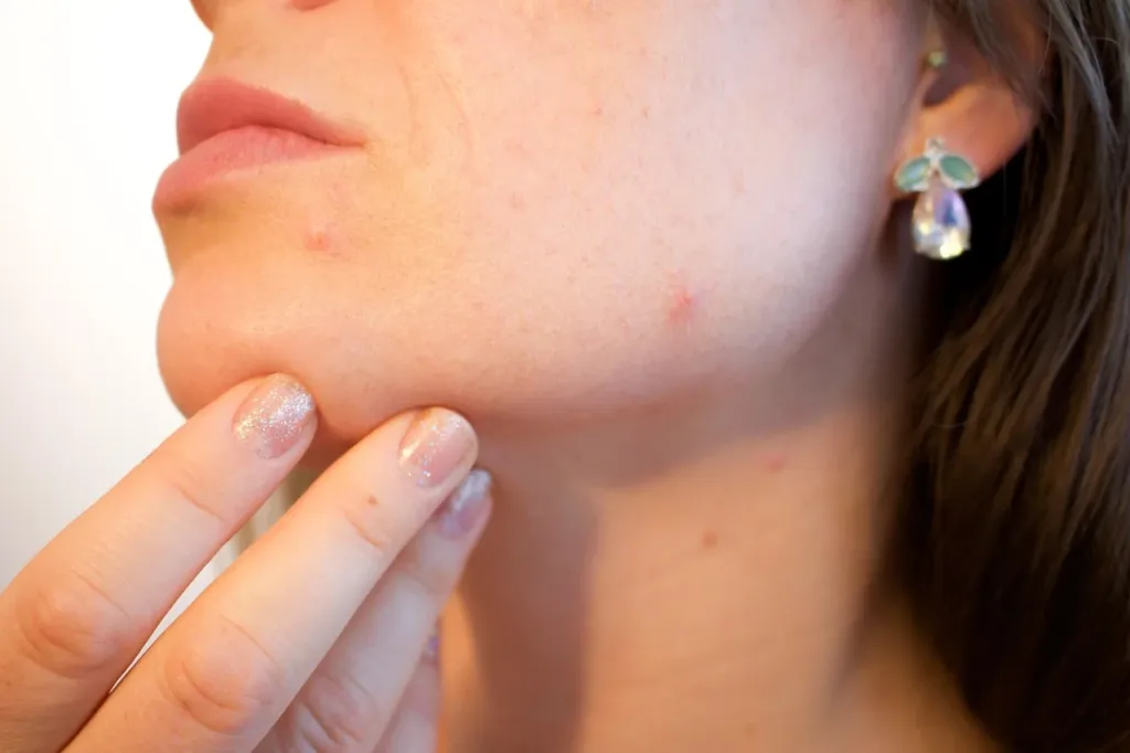 Szklana buteleczka z serum i liście aloesu na marmurowym blacie, symbolizujące naturalną pielęgnację cery z przebarwieniami.